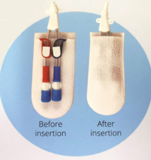 CathGuard-Catheter_1000x1000