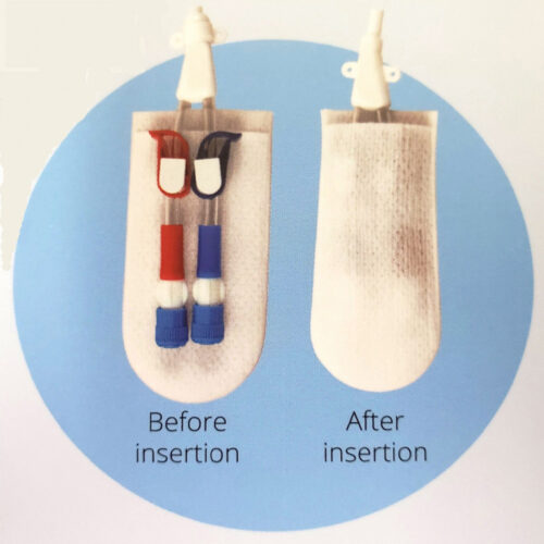 CathGuard-Catheter_1000x1000