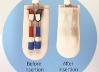 CathGuard-Catheter_Insertion_2_website-200x145